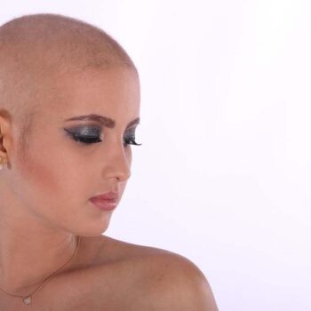 Deux célébrités qui ont parlé ouvertement de leur chute de cheveux