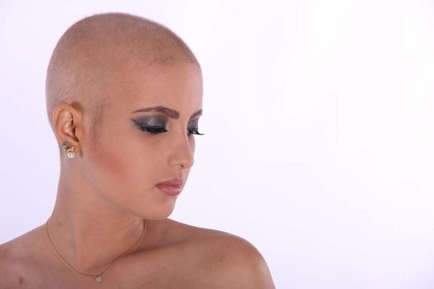Deux célébrités qui ont parlé ouvertement de leur chute de cheveux